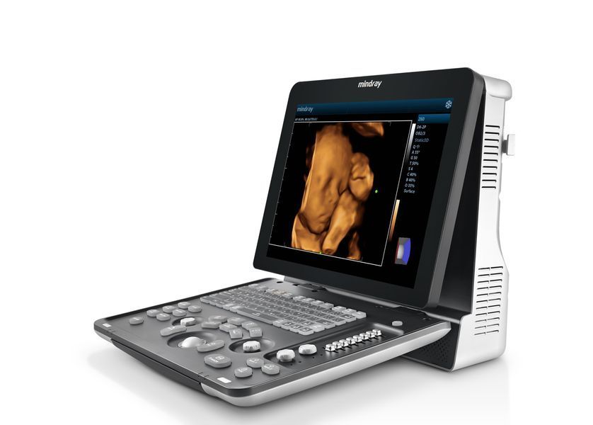 Cистема ультразвуковая диагностическая Mindray Z60
