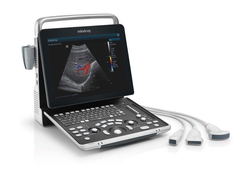 Cистема ультразвуковая диагностическая Mindray Z60